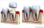 طرح جابر کلاس ششم ابتدایی پوسیدگی دندان به همراه دفتر کارنما - نسخه ورد